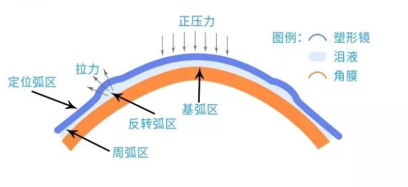 OK鏡原理示意圖