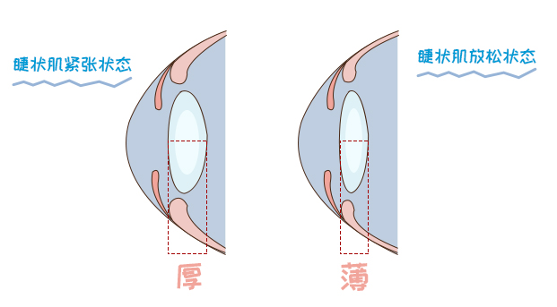 睫狀肌持續(xù)收縮