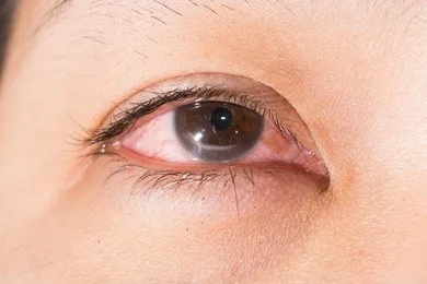 388682296.webp.jpg