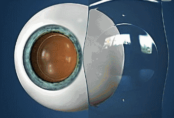 ICL2.gif