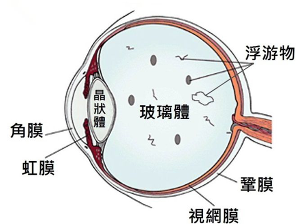 近視,遠(yuǎn)視,老花眼,散光眼,白內(nèi)障,飛蚊癥,?，斞劭漆t(yī)院
