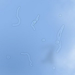 飛蚊,病癥,玻璃體,視網(wǎng)膜,珠海?，斞劭漆t(yī)院